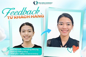 Chị Dương Thu Hà tự tin với nụ cười mới nhờ bọc sứ tại Hanseoul