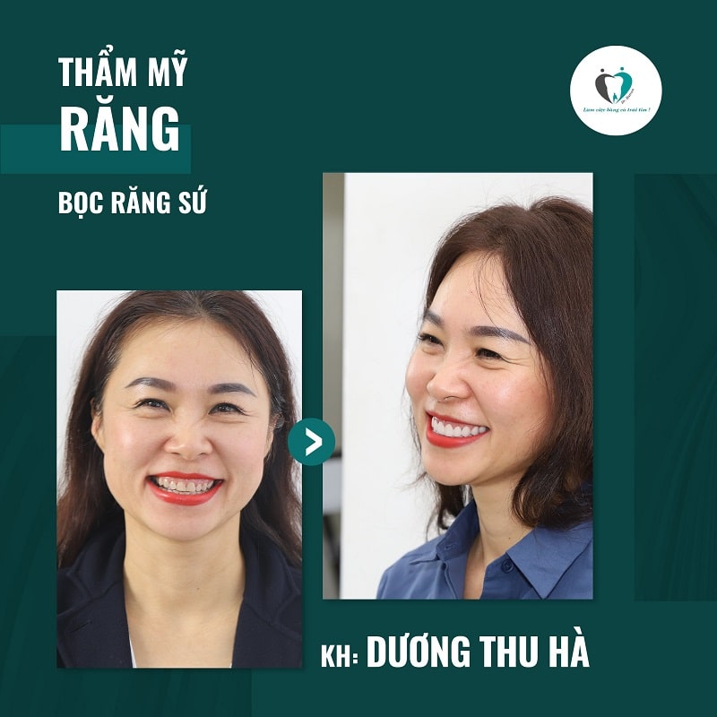 Khách hàng bọc răng sứ tại Hanseoul