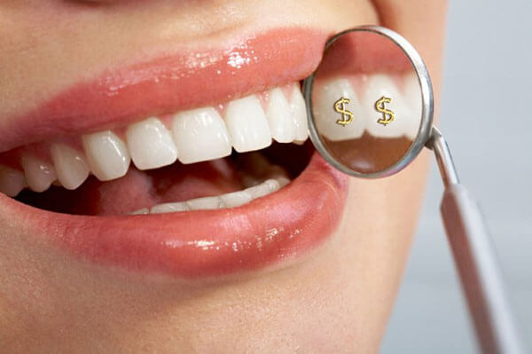 Hình ảnh bọc răng sứ đẹp