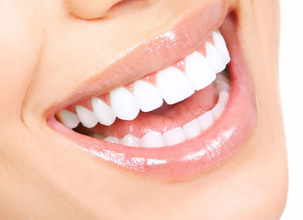 Lợi ích của bọc răng sứ toàn hàm