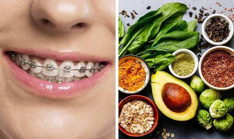 Món ăn mềm cho người niềng răng