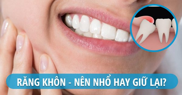 Nhổ răng khôn có đau không