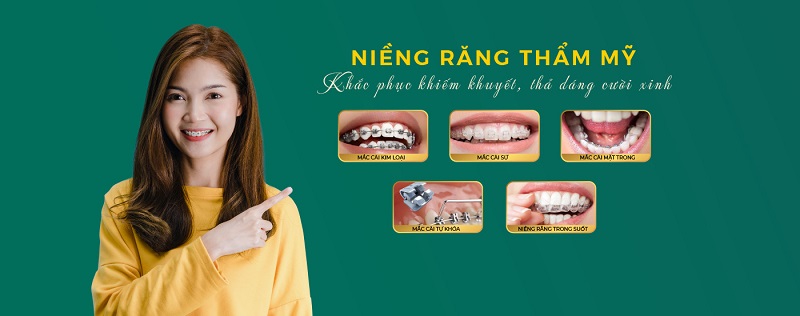 Niềng răng thẩm mỹ