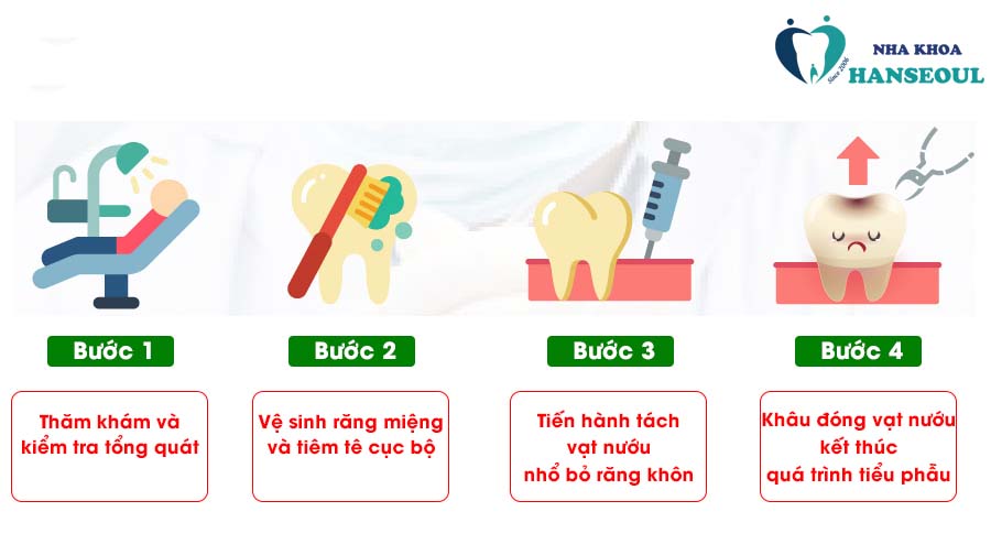 Quy trình nhổ răng khôn