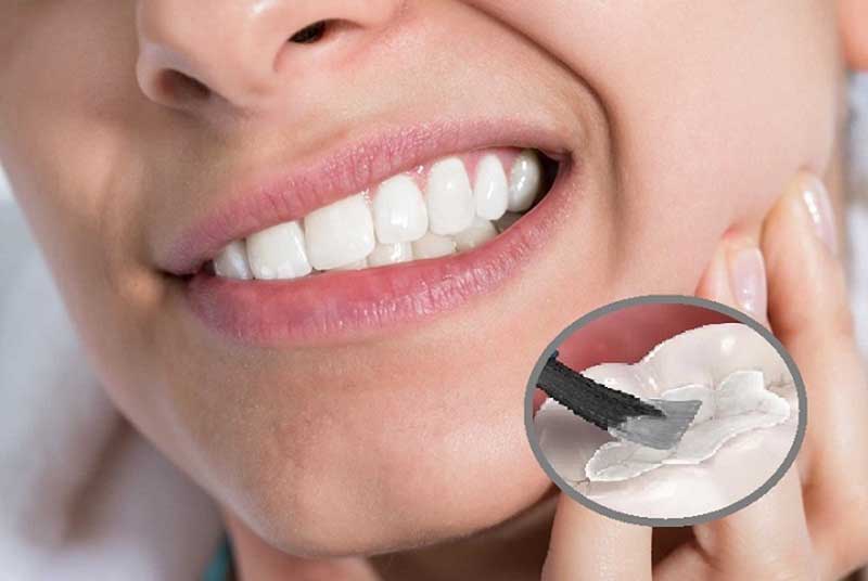 Tác hại của trám răng thẩm mỹ