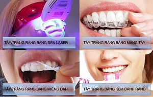 Nha khoa gần đây tại Quận 2 tốt