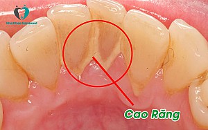 Nha khoa gần đây tại Quận 2 tốt