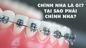 Niềng răng uy tín tại Quận 2 an toàn, chuẩn y khoa