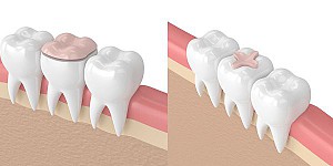 Nha khoa gần đây tại Quận 2 tốt