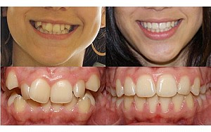 Nha khoa gần đây tại Quận 2 tốt