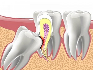 Nha khoa gần đây tại Quận 2 tốt