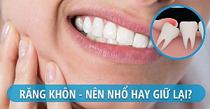 Nhổ răng khôn an toàn, không đau tại Hoài Đức, Hà Nội
