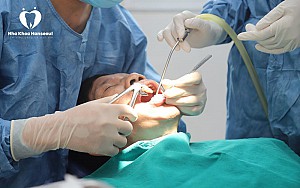 Nhổ răng khôn an toàn, không đau tại Hoài Đức, Hà Nội
