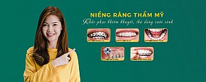 Niềng răng uy tín tại Quận 2 an toàn, chuẩn y khoa