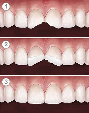 Nha khoa gần đây tại Quận 2 tốt