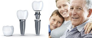 Hanseoul Mon Bay – nơi trồng răng Implant uy tín tại Hạ Long Quảng Ninh