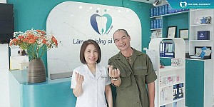 Không còn hô và hở lợi – Hành trình 13 tháng niềng Invisalign của Khánh Việt