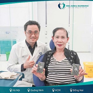 Hiệu quả niềng răng sớm sau 3 năm – màn lột xác ấn tượng của khách hàng Võ Đức Kiên (2012)
