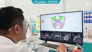 Địa chỉ trồng răng implant uy tín tại Sài Gòn - Yếu tố quyết định ca cấy ghép thành công