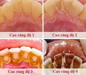 Nha khoa gần đây tại Quận 2 tốt