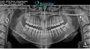 Sự tận tâm của bác sĩ giúp nụ cười của tôi sang trang mới