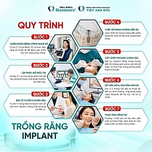 Tại Sao Giá Implant Tại Việt Nam Tốt Hơn Nước Ngoài Nhưng Chất Lượng Tương Đương?