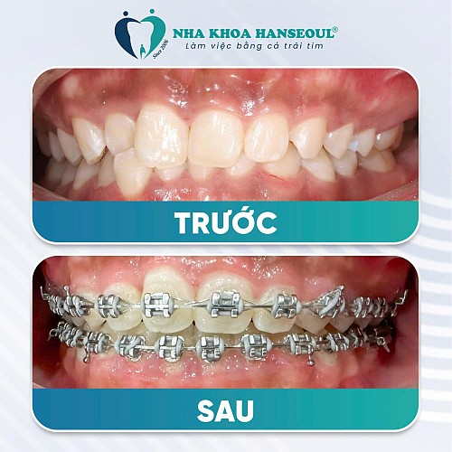 kh-tran-yen-nhi-thay-doi-ngoan-muc-sau-gan-2-nam-nieng-rang-mac-cai thumbnail