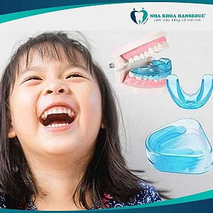 CÁCH NIỀNG RĂNG TẠI NHÀ: Niềng răng tại nhà có khó không?