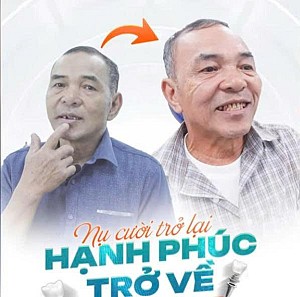 Trải nghiệm cấy implant nhẹ như không của anh Oliver Sepp đến từ Estonia