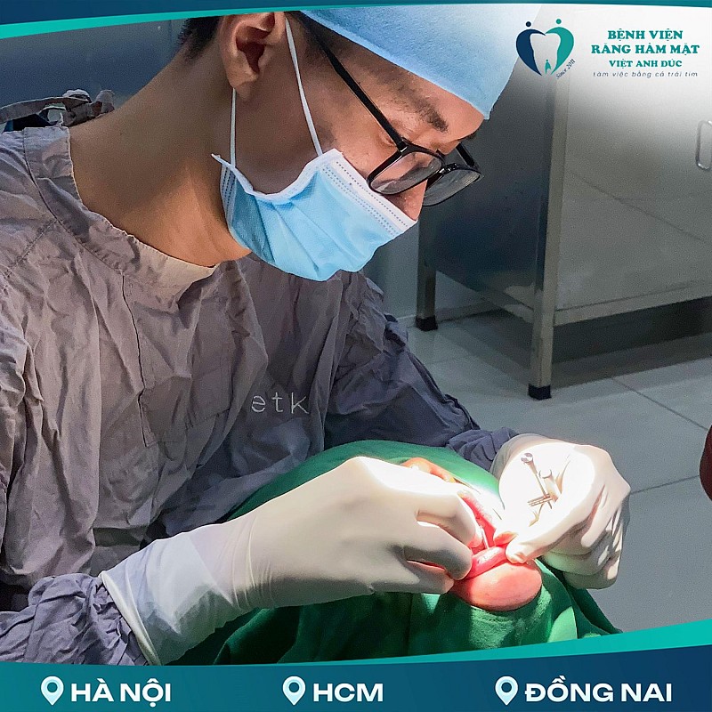 VIỆT ANH ĐỨC - ĐỊA CHỈ TRỒNG RĂNG IMPLANT UY TÍN TẠI BIÊN HÒA ĐỒNG NAI VIỆT ANH ĐỨC - ĐỊA CHỈ TRỒNG RĂNG IMPLANT UY TÍN TẠI BIÊN HÒA ĐỒNG NAI