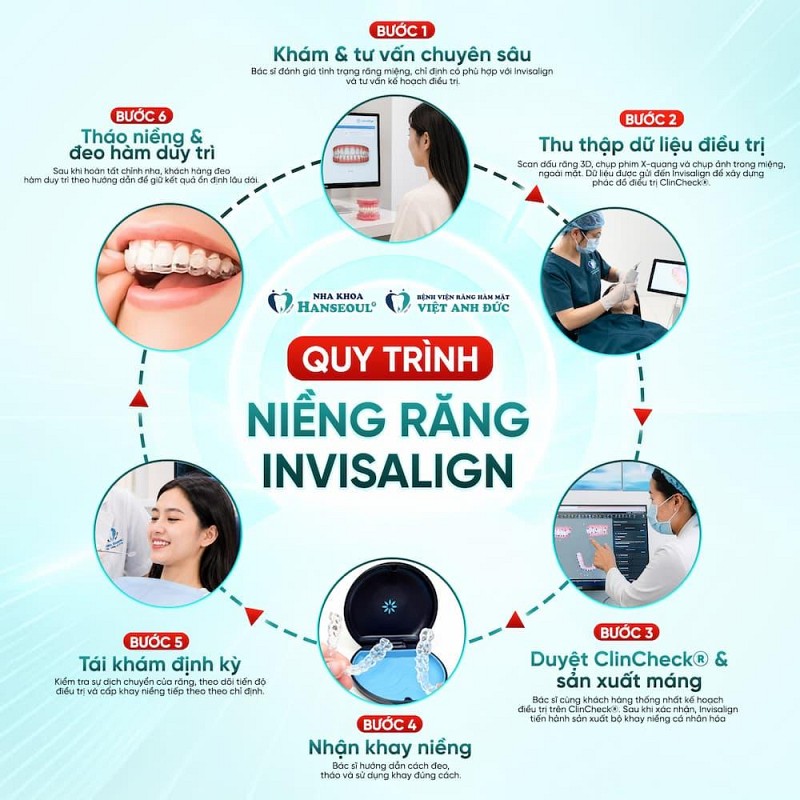 Quy trình niềng răng Invisalign chuẩn y khoa: 6 bước tại Nha khoa Hanseoul Quy trình niềng răng Invisalign chuẩn y khoa: 6 bước tại Nha khoa Hanseoul