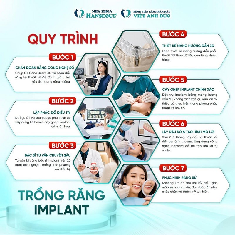 Quy trình đặt lịch khám Trồng Implant chuẩn bị trước khi về nước Quy trình đặt lịch khám Trồng Implant chuẩn bị trước khi về nước