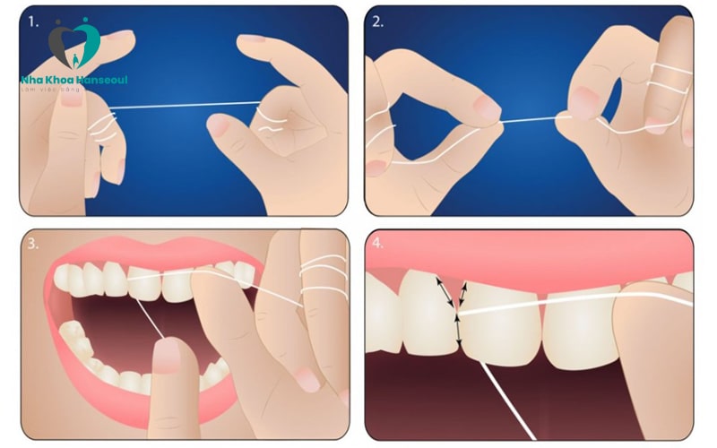 Cách sử dụng chỉ nha khoa dạng cuộn