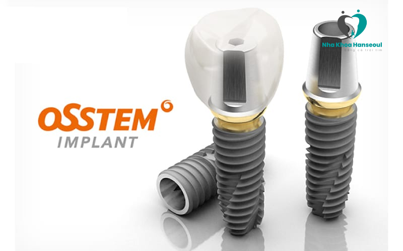Implant Osstem, công nghệ trồng răng tốt nhất Châu Á