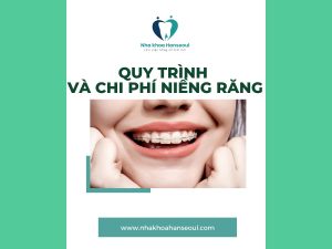 quy trình niềng răng diễn ra như thế nào?