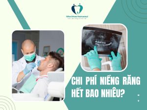 chi phí niềng răng hết bao nhiêu