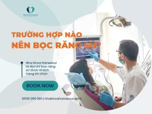 trường hợp nào nên bọc răng sứ? Giá bọc răng sứ bao nhiêu?