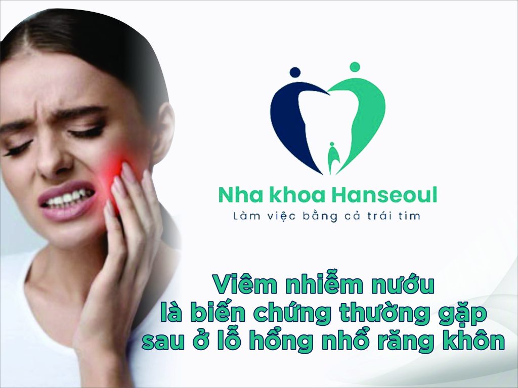 Viêm nhiễm nướu là biến chứng thường gặp sau ở lỗ hổng nhổ răng khôn