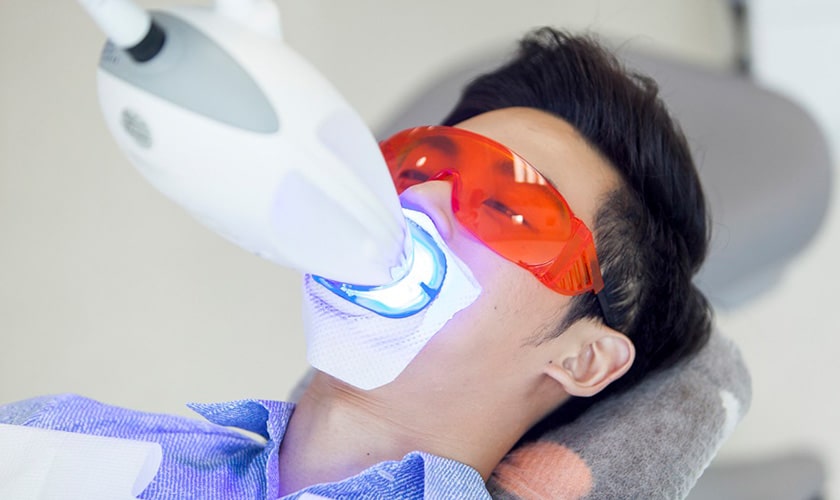 Tẩy trắng răng công nghệ laser whitening