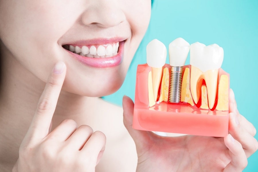 Trồng răng implant có đau không