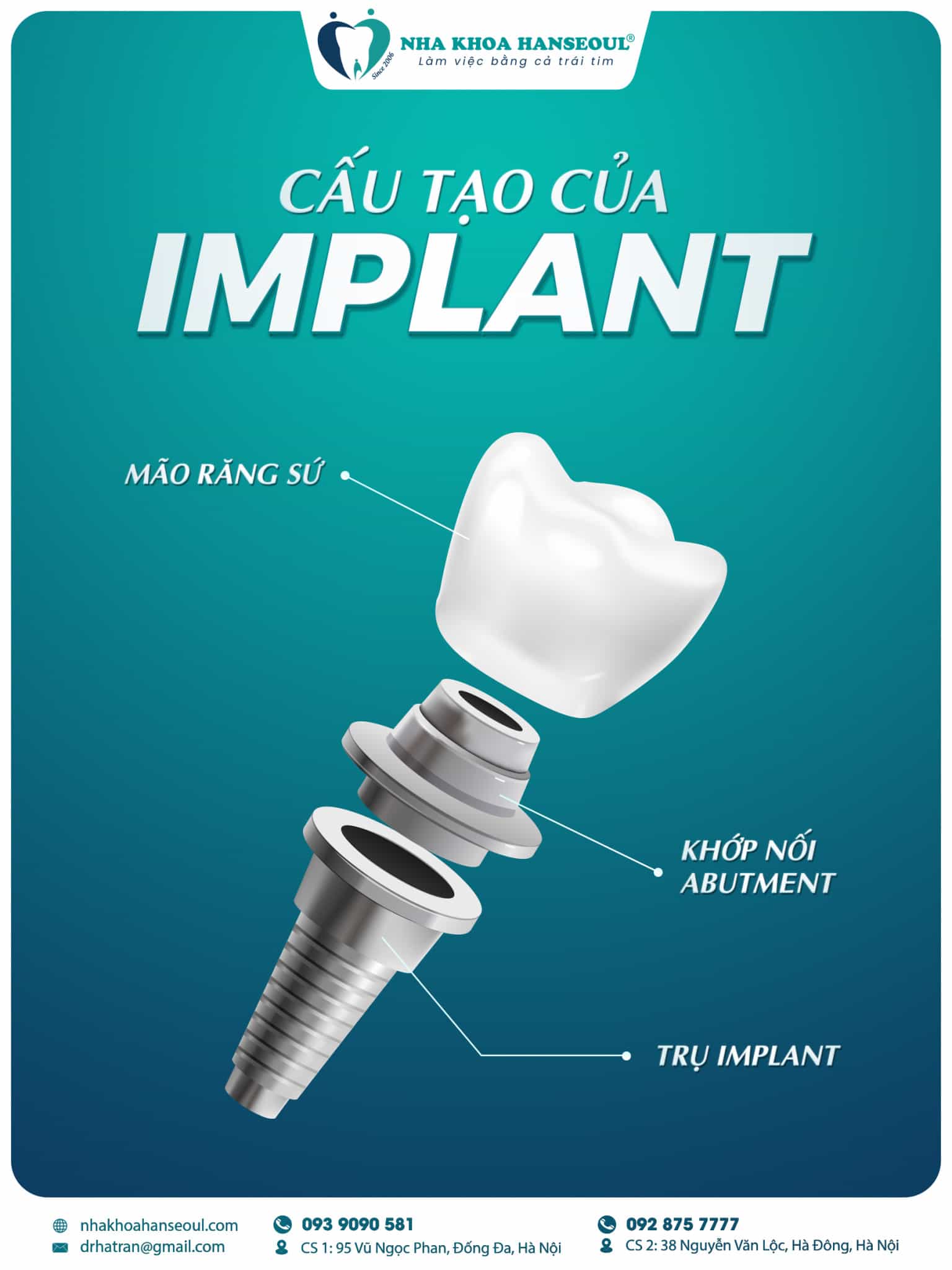 trong-rang-implant-la-gi