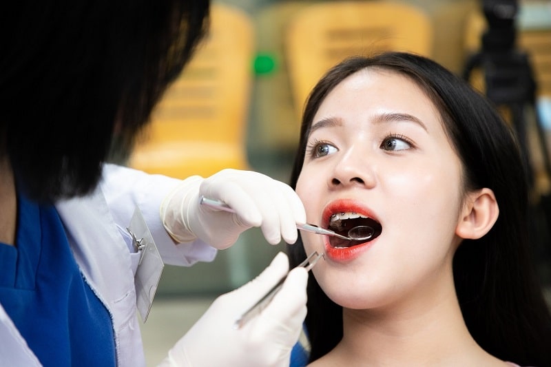 Độ tuổi thích hợp niềng răng