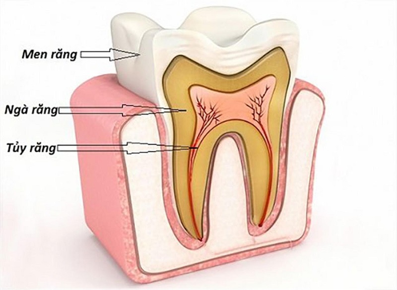 Hình ảnh tủy răng