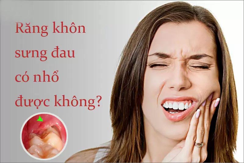 Nhổ răng 8 có đau không