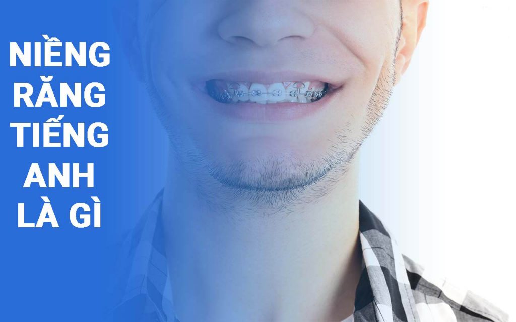 Niềng răng tiếng anh là gì