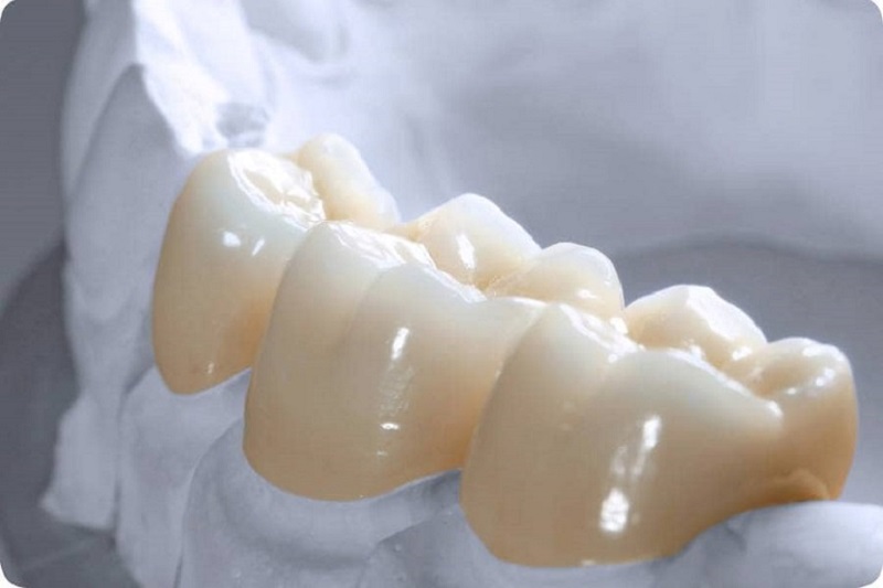 Răng sứ zirconia