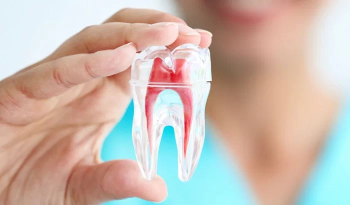 Thế nào là điều trị tủy răng
