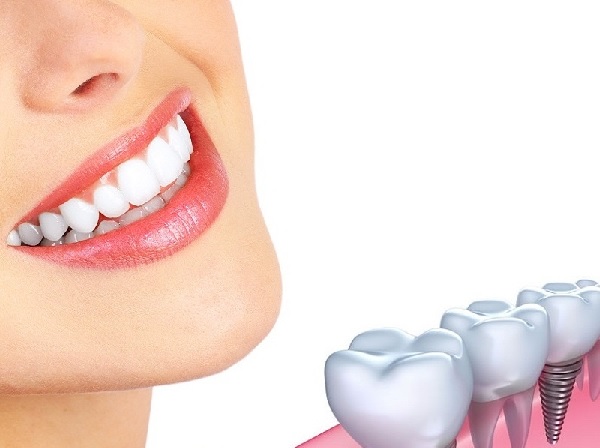Trồng răng implant có nguy hiểm không