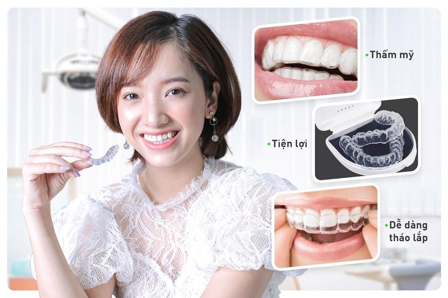 Ưu điểm niềng răng Invisalign