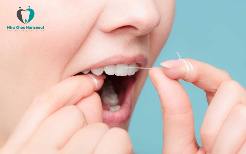 dung-chi-nha-khoa Chỉ nha khoa dạng cuộn